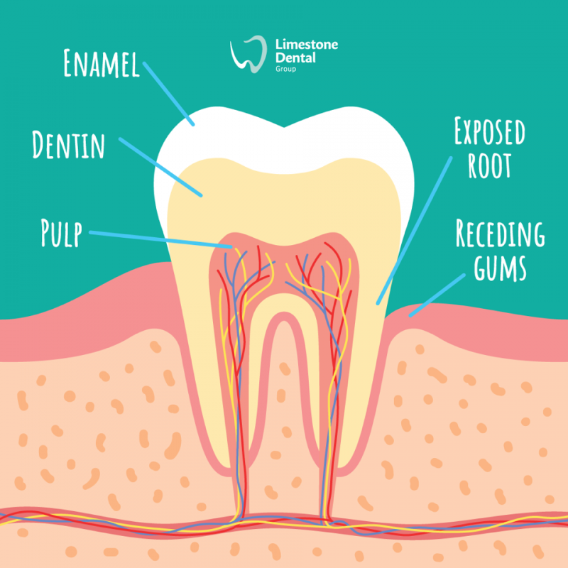 Sensitive Teeth causes and how to reduce the problem » Ipswich Dentist